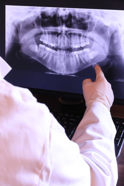 Best Emergency Treatment for Oral Infections in New Holland, PA